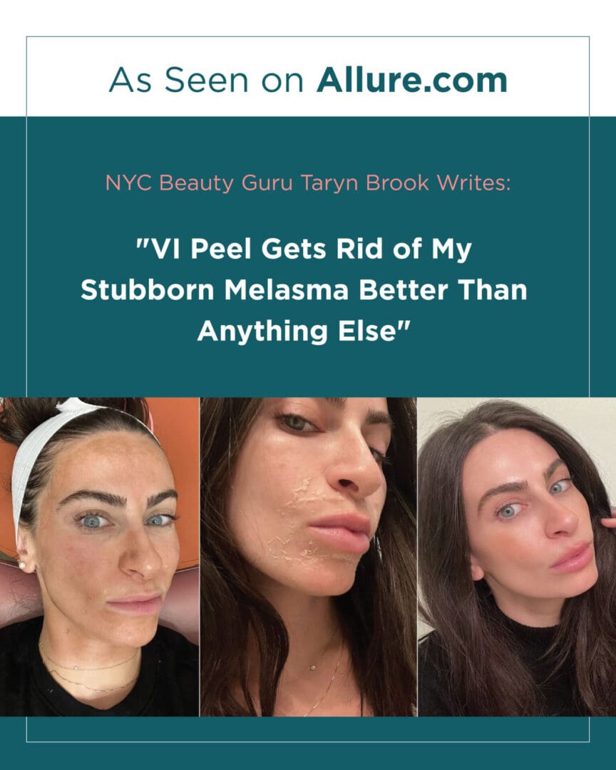 Quote by NYC Beauty Guru Taryn Brook praising VI Peel for effectively treating stubborn melasma