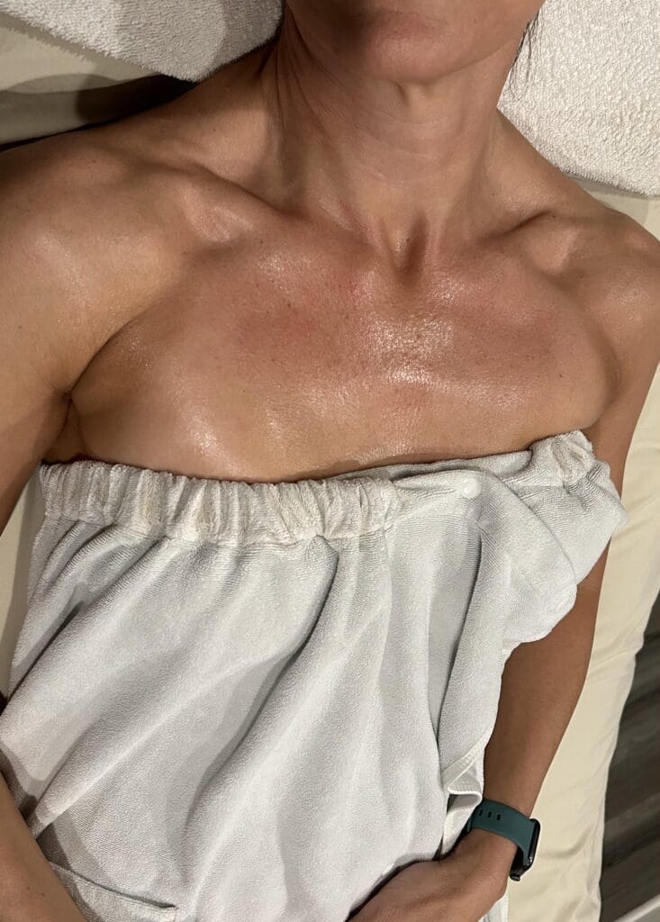 BioRePeel_Chest_After