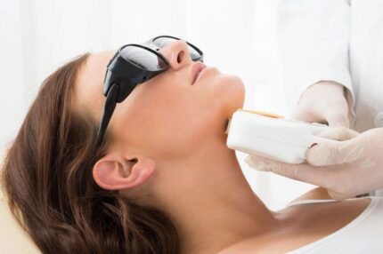 Woman receiving laser hair removal on chin